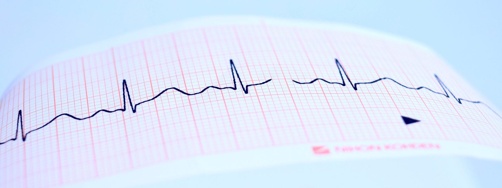Image of an ECG wave that's broken in the middle