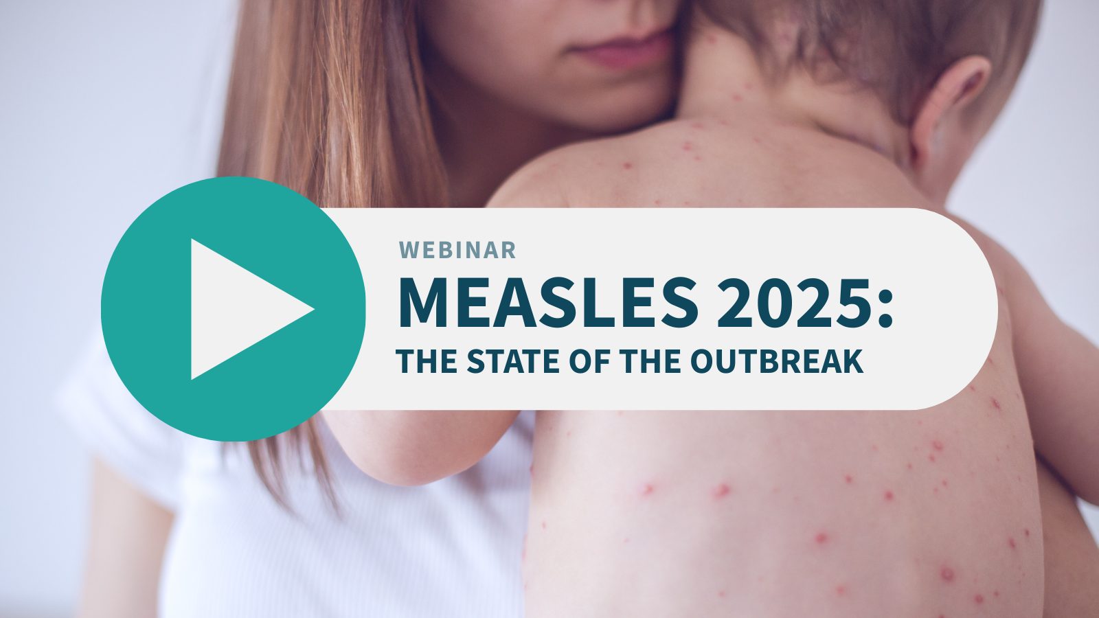 Measles webinar - The State of the Outbreak